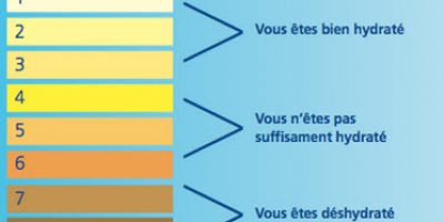 signification couleur urine