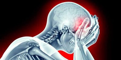 migraine chronique